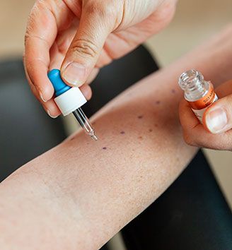 Allergie-Test Hautarzt Oberland